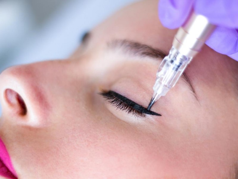 میکروپیگمنتیشن چیست