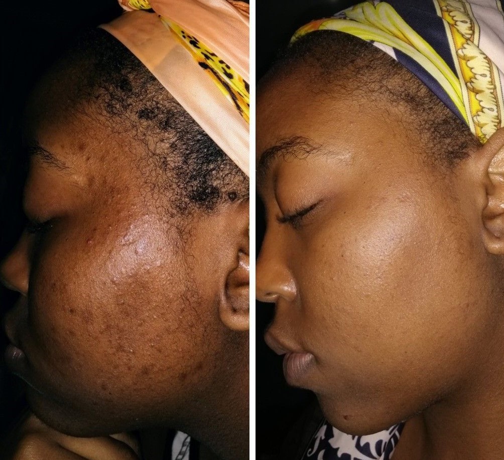 برندهای شفاف کننده پوست