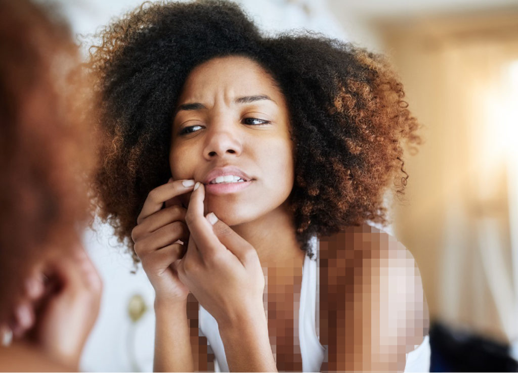 انواع ماسک خانگی و کارخانه‌ای مناسب جوش صورت