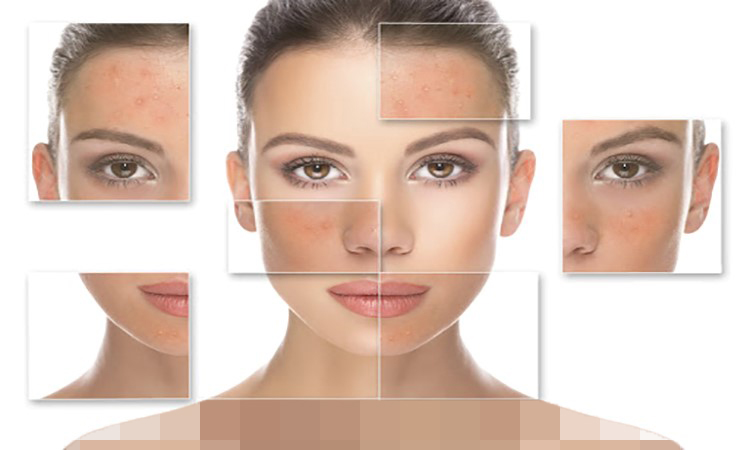بهترین پن و صابون برای پوستهای حساس