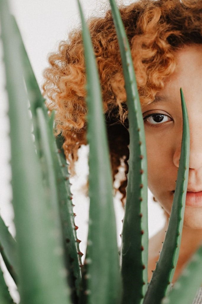 درمان جوش با آلوئه ورا